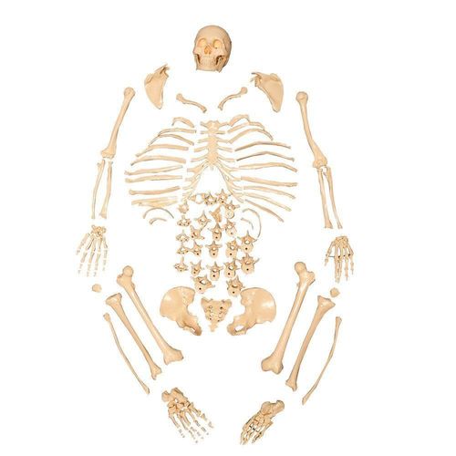 Esqueleto Humano Padrão Tamanho l Desarticulado